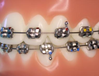 SML Mini Bracket Set